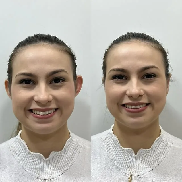 Comparativo de resultado de paciente