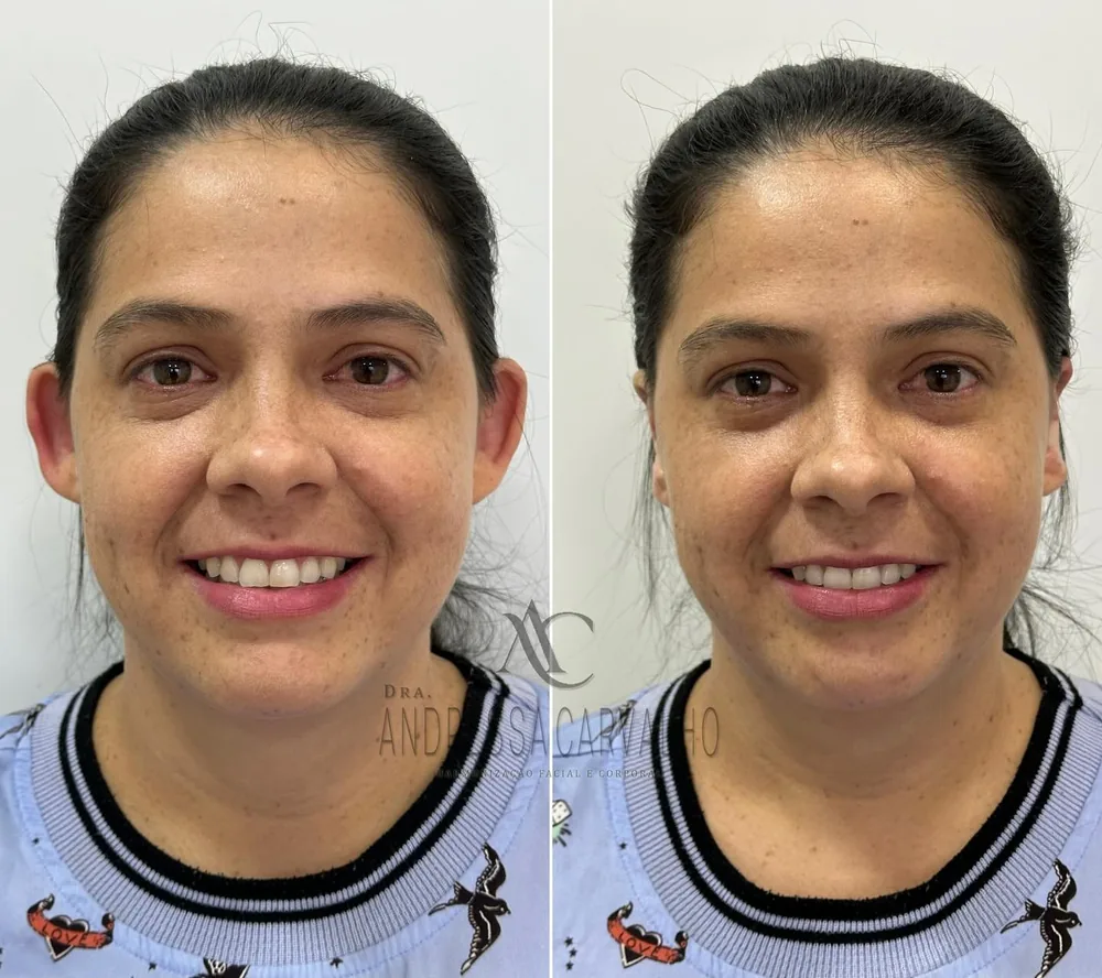 Comparativo de resultado de paciente