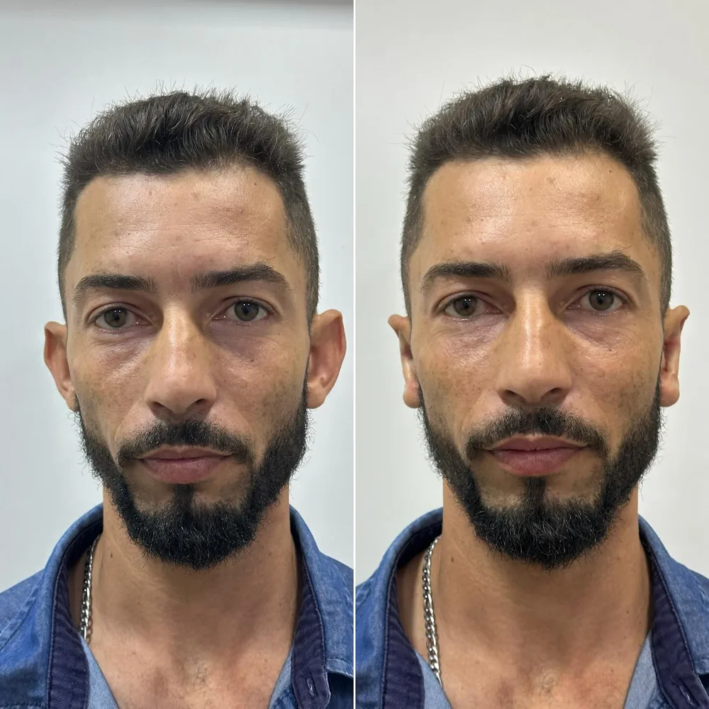 Comparativo de resultado de paciente