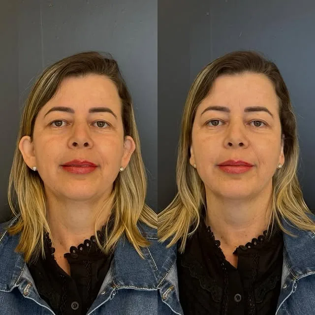 Comparativo de resultado de paciente