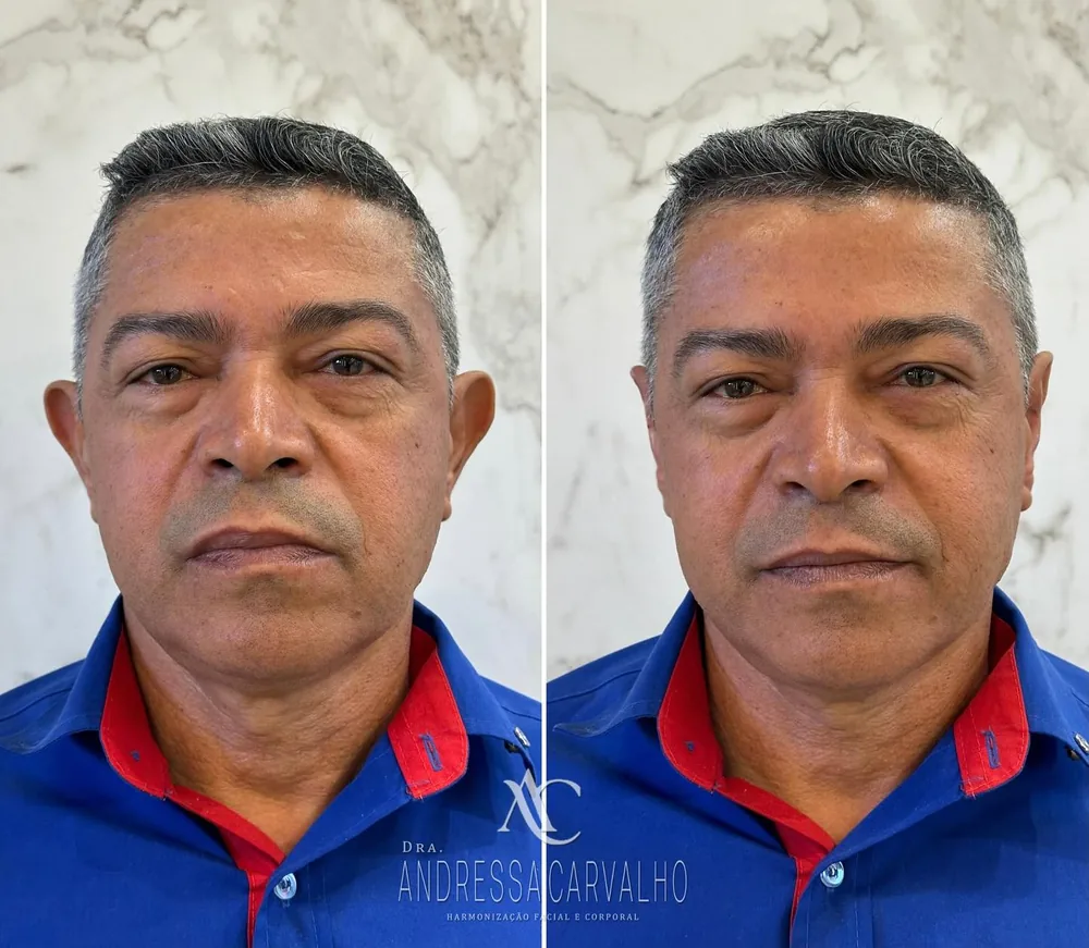 Comparativo de resultado de paciente