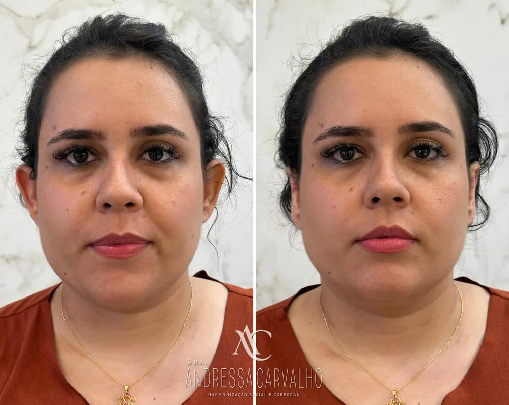 Comparativo de resultado de paciente