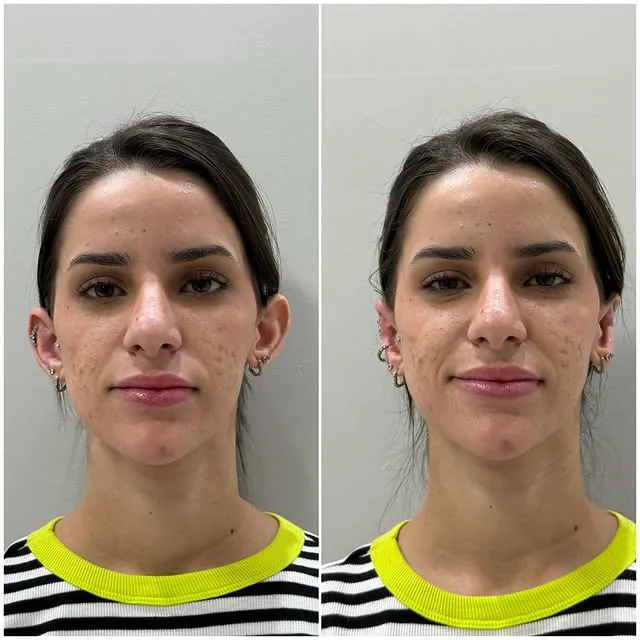 Comparativo de resultado de paciente